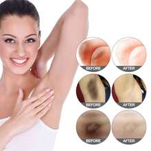 Crema Aclaradora Corporal | Aclara Manchas Oscuras en Axilas, Codos y Rodillas, Crema reparadora que reduce la melanina y las zonas oscuras en articulaciones, hidrata y nutre la piel, uniforma el tono y deja la piel suave, radiante y bella. - Niacinamide - Ver 5