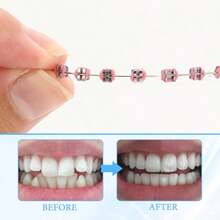S Falsos Para DientesBraces Kit Wit S And Wire S Para Dientes  Dental Students And Ortic Practice Ro Red - 如圖所示 - 查看 3