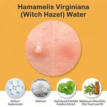 GRGR 792pcs Shaped Pimple Patches, Pimple Patches For Face, Nvisible Non-Drying Pimple Cover Dots For All Light Beige Types, Gentle Absorption, Pimple Patches For Face, Durable Packaging, Gift For Mom - 792Pcs - View 5