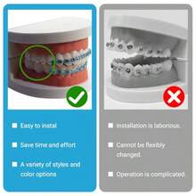 1 Pair Of Temporary Toot Ration Teet Retainer Practical S Para Dientes Sturdy Retenedores De Dientes Ortocia Props  Dental Students To Practice Blue - 藍色 - 查看 6