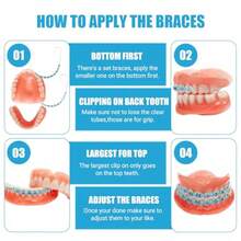 1 Pair Of Temporary Toot Ration Teet Retainer Practical S Para Dientes Sturdy Retenedores De Dientes Ortocia Props  Dental Students To Practice Blue - 藍色 - 查看 4