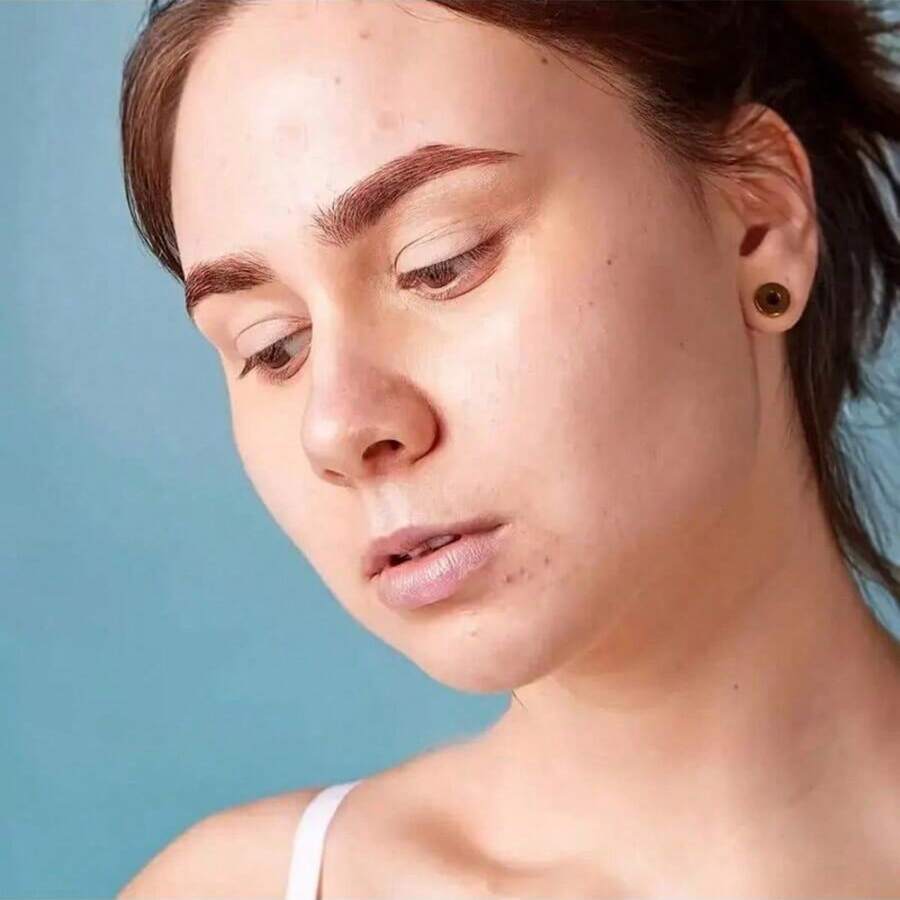 防水加厚矽膠凝膠疤痕遮瑕貼 - 彩色 - 查看 1