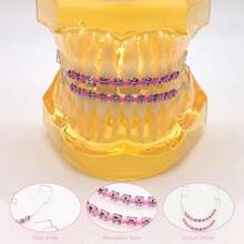 1 Pair Of Temporary Toot Ration Teet Retainer Practical S Para Dientes Sturdy Retenedores De Dientes Ortocia Props  Dental Students To Practice Pink - 粉色 - 查看 5