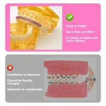 1 Pair Of Temporary Toot Ration Teet Retainer Practical S Para Dientes Sturdy Retenedores De Dientes Ortocia Props  Dental Students To Practice Pink - 粉色 - 查看 6