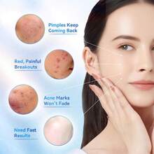 Dr.Leo 24H Acne Drying Lotion – Overnight Spot Treatment With Salicylic Acid + Sulfur + Niacinamide, Reduces Cystic Pimples & Inflammation, Post-Blemish Care For Clear Skin - Nhiều màu - Xem 5