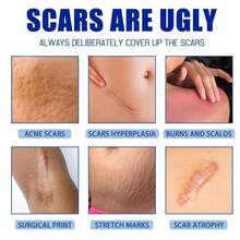 30g Silicone Scar Gel Scar Removal Cream, Night Treatment For Acne, Surgical Scars, Keloid Bump & Stretch Marks - D-棕色 - 查看 5