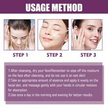 Nicotinamide Facial Essence Liquid, Containing Glycerin, Purslane Extract, Acetyl Chitosan, Can Tighten, Fade Spots, Resist Wrinkles, Moisturize, Nourish The Skin, Purify Pores, Care And Beautify The Skin. It Is A Good Gift For Holidays And An Ideal Gift For Mother's Day. - Hyaluronic Acid - 查看 3
