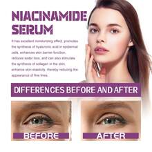 Nicotinamide Facial Essence Liquid, Containing Glycerin, Purslane Extract, Acetyl Chitosan, Can Tighten, Fade Spots, Resist Wrinkles, Moisturize, Nourish The Skin, Purify Pores, Care And Beautify The Skin. It Is A Good Gift For Holidays And An Ideal Gift For Mother's Day. - Hyaluronic Acid - 查看 7