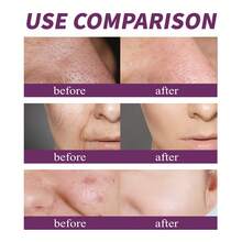 Nicotinamide Facial Essence Liquid, Containing Glycerin, Purslane Extract, Acetyl Chitosan, Can Tighten, Fade Spots, Resist Wrinkles, Moisturize, Nourish The Skin, Purify Pores, Care And Beautify The Skin. It Is A Good Gift For Holidays And An Ideal Gift For Mother's Day. - Hyaluronic Acid - 查看 5
