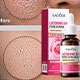 Collagen