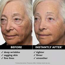 Peter Thoma Roth Instant ® Temporary Face Tightener, Tighten Firm And Smooth Facial Area, Minimize Appearance Of Fine Lines And Deep Wrinkles - Nhiều màu - Xem 3