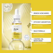 Acne Removing And Skin Clearing Essence Can Improve Oily Acne Muscle, Control Oil, Refine Pores, Reduce Defects, Relieve Redness, Fade Acne Mark Sensitive Muscle, Available 30ml - axit salicylic - Xem 7