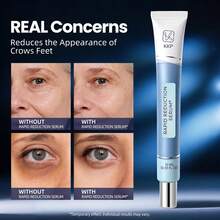 KKP Rapid Reduction Eye Serum - Visibly Reduces Under-Eye Bags, Wrinkles, Dark Circles, Fine Lines & Crow's Feet Instantly, Anti Aging Wrinkle Remover For Face, 3 Full Size Tubes - 3 PACK/1 fl oz - 查看 5