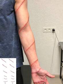 1片可水洗红色缝线假伤口纹身贴纸，手臂/手腕个性化创意防水贴纸，可持续2-3天 - 紅色 - 查看 3