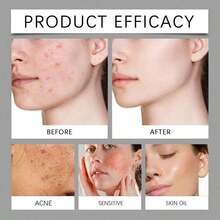 100g Lavender Tallow Honey Balm - Brightening Fade Dark Spots Firming Powerful Nourishing Repair Damaged Barrier Relieve Skin Redness Soothe Discomfort Lasting Fragrance - 香脂 - 查看 10