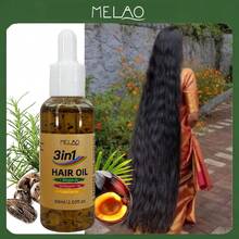 MELAO 三合一护发油套装，含巴巴苏油、迷迭香油和蓖麻油，适用于干性及毛躁发质，抚平毛躁，令秀发极致亮泽柔顺，滋养修护，天然香氛，60毫升/2.03液盎司 - 60毫升 - 查看 3