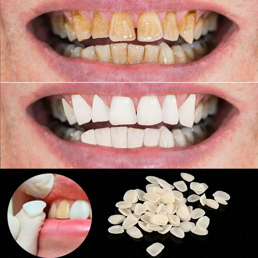 50 miếng dán làm trắng răng, đơn giản và tiện lợi, phù hợp với nhiều hình dạng răng, tăng cường sự tự tin và vẻ đẹp nụ cười, dùng hàng ngày cho cả nam và nữ, món quà tinh tế. - Nhiều màu - Xem 1