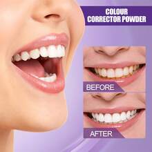 EELHOE Teeth Whitening Purple Powder - Colour Corrector Powder - Remove Food Particles And Deep-Seated Stains, Brightness Improvement, Odor Elimination, Long-Lasting Freshness, Dental Bleaching Care Tools - 粉末狀 - 查看 7