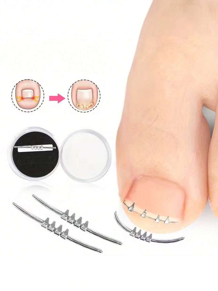 1pc Adjustable Toe Nail Fixator, Designed To Stabilize Toes And Relieve Ingrown Toenail Issues - With Detachable Structure, Unisex - Multicolor - View 1