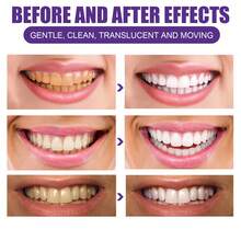 EELHOE Teeth Whitening Purple Powder - Colour Corrector Powder - Remove Food Particles And Deep-Seated Stains, Brightness Improvement, Odor Elimination, Long-Lasting Freshness, Dental Bleaching Care Tools - 粉末狀 - 查看 4