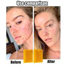 A 4-Piece Turmeric Facial Cleansing Set, Featuring A Pack Of 30 Facial Cleansing Wipes, Three Handmade Turmeric & Kojic Acid Soaps, And A Bottle Of Turmeric & Damask Rose Cleansing Mousse. This Set Offers Deep Cleansing And Moisturizing Benefits, Enriched With Abundant Curcumin, Vitamin E, And Rose Essence; Its Natural, Gentle Formula Is Suitable For Use On Both The Face And Body. - Vệ sinh sâu - Xem 5