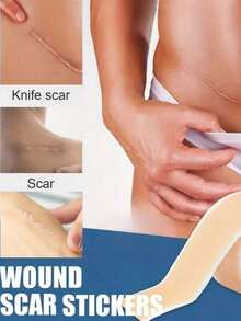 Reusable Silicone Scar Patch - Suitable For C-Section, Acne, Burns, Surgery And Stretch Marks - Smooth, Moisturizing Light Beige Solution, Improving Patch | Flexible Application | Multi-Functional Skincare, Surgery, Burns, Postpartum Scar Invisible Silicone Cover Tape, Fragrance-Free, Personal Care Essential, Tattoo Accessory - Multicolor - View 3