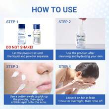 Salicylic Acid Acne Treatment Drying Lotion - 1 - 查看 9