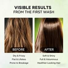Hoegoa Champú De Romero Para Volumen, Hidrata Profundamente, Refrescante, Controla La Grasa, Repara El Pelo Seco Y Encrespado, Fortalecedor De Raíces, Mejora La Textura - romero - Ver 4