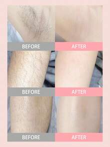 Manual Hair Removal Razor, Gentle Skin-Friendly Shaving Tool For Underarms, Legs, Intimate Areas, With Anti-Scratch Protection, Suitable For Summer, Women's Underarm Shaver, Travel Shaving Razor - View 7
