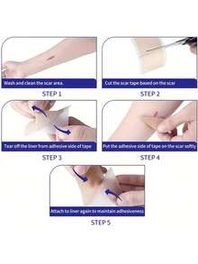 Reusable Silicone Scar Patch - Suitable For C-Section, Acne, Burns, Surgery And Stretch Marks - Smooth, Moisturizing Light Beige Solution, Improving Patch | Flexible Application | Multi-Functional Skincare, Surgery, Burns, Postpartum Scar Invisible Silicone Cover Tape, Fragrance-Free, Personal Care Essential, Tattoo Accessory - Multicolor - View 5