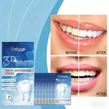 Oralhoe Tiras Blanqueadoras de Dientes 3D White, Tratamiento de Blanqueamiento Dental Intensivo, Para eliminar manchas y decoloraciones en los dientes, especialmente eficaz contra manchas difíciles como el café o el té. Elimina Manchas y Refresca el Aliento, Fórmula Suave Sin Sensibilidad, Fáciles de Usar, 7 Pares para 7 Días de Tratamiento - Tiras blanqueadoras de diente - Ver 2