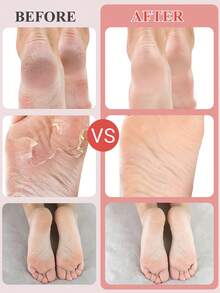 5 Packs Foot Peel Mask Skin Exfoliating Foot Masks For Dry, Cracked Feet & Callus Removal Exfoliator Foot Mask - View 3