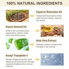 Cyperus Rotundus Oil, Natural Cyperus Rotundus Oil For Hair Removal, Reduces Unwanted Hair Growth, Moisturizes & Soothes The Skin, Reducing Body Hair Growth, Shrink Pores, Suitable For All Skin Types - 花香調 - 查看 4