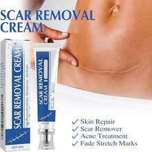 Silicone Scar Gel, Scar Cream For Surgical Scars, Stretch Marks & Keloid Bumps, Effective Scar Removal Cream (1 Pc) - A - 查看 3
