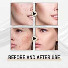 JAYSUING Lactobionic Acid Shrink Pore Serum For Gentle Exfoliation Remove Blackheads And Shrink Pores Deeply Moisturize Skin Smooth And Firm Skin Smooth Eye Lines And Fade Forehead Lines Improve Elasticity Anti-Aging Serum - Lactobionic Acid - 查看 5