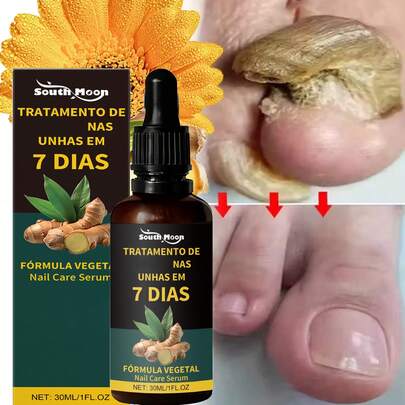Ginger Essential Oil for Feet, with a Ginger Aroma, Multi-Purpose, for Feet And Nails, 30M