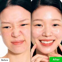 Chiết xuất Phellodendron Amurense | Serum Vitamin C | Serum kích hoạt peptide NAD+ | Serum làm dịu da Aloe PDRN | Serum Hyaluronic Acid làm sáng da - Tác động kép chống lão hóa và làm sáng da, giúp da rạng rỡ và săn chắc hơn | Serum làm sáng da dịu nhẹ thay thế Retinol và giàu vitamin - Nhiều màu - Xem 12