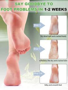 5 Pairs Foot Peeling Mask Exfoliating Foot Mask For Dry Cracked Feet With Lavender & Shea Butter, Dead Skin & Callus Remover For Feet, Exfoliating Socks For Women & Men - 查看 5