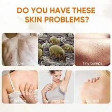Body Wash with  Antibacterial For All Skin Types Protects from Dryness - Opción 1 - Ver 11