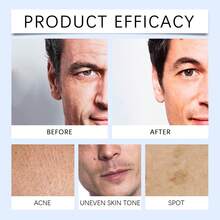 Men's Oil-Control Scrub: Deeply Cleanses, Controls Oil, And Moisturizes; Suitable For All Skin Types; Balances Oil And Moisture; Produces Rich Foam, Leaving Skin Refreshed, Clear, And Non-Greasy. - Men's Oil-control Scrub - View 10