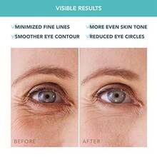 FOREO IRIS Parches Ojos con Colageno - Contorno de Ojos Antiojeras - Vitamina B Vitamina C y Vitamina E - Retinol - Antiojeras Mujer - Hidratante - Vegano - 60 Parches Ojeras - como en la imagen - Ver 7