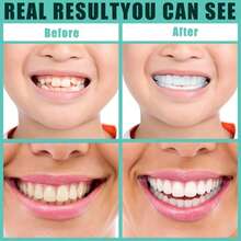 4pcs/Set New Comfortable Fit Upper And Lower Teeth Decorative Accessories, Suitable For Men And Women For Daily, Party And Vacation Use - White - View 6