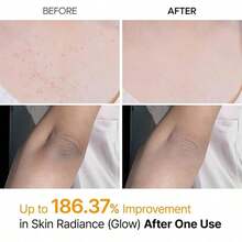 Dr. Melaxi Kojic Acid & Turmeric Face Spray |   Body Peel Shot For Dark Spot Treatment, Brightening & Exfoliating |   Gentle Exfoliator For Glowing Skin, Even Tone |    Korean Exfoliating Solution Skin Care Suitable For All Skin Types  200ml - AHA - View 5