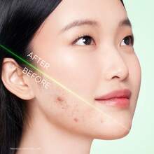 SKINTIFIC 4D Oxygenated Foam Cleanser, Calming Hydrating Non-Stripping Face Wash, For Oily Acne-Prone Sensitive Skin - 3X ACID ACNE GEL CLEANSER - View 7