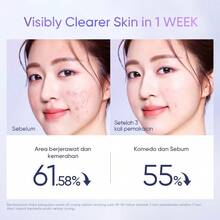 SKINTIFIC 去角质爽肤棉片 | 清洁毛孔，清除粉刺和黑头，温和去角质，焕亮肌肤，柔滑舒缓，烟酰胺美白，AHA、BHA、PHA酸，淡化黑斑，痘印，清透保湿棉片 - toner pads-40 pads - 查看 5