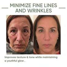 OUHOE Suero Facial Antienvejecimiento con Esencia de Aguacate, Ácido Hialurónico, Extracto de Té Verde, Hidratante y Revitalizante, Reducir las líneas finas y los poros, Mejora la Elasticidad Cutánea, Ilumina la piel oscura y mejora la desigualdad de tono, con Resultados Visibles en 28 Días, Ideal para el verano, estilo Y2K, excelente para fiestas y regalos - Suero Facial de Aguacate - Ver 5