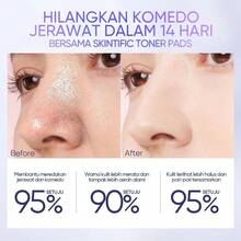 SKINTIFIC 去角质爽肤棉片 | 清洁毛孔，清除粉刺和黑头，温和去角质，焕亮肌肤，柔滑舒缓，烟酰胺美白，AHA、BHA、PHA酸，淡化黑斑，痘印，清透保湿棉片 - toner pads-40 pads - 查看 7