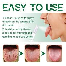 Oral Cleaning Spray For Tongue Cleansing, Contains Peppermint Extract And Castor Oil, Repairs And Soothes White Coating On The Tongue, Relieves Dryness And Cracking. Suitable For All Occasions. - Fresh - View 5