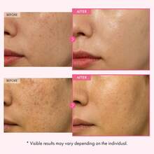 Free Shipping & Buy 1 Get 1 Free | High Concentration Arbutin Glutathione Cream With Niacinamide, Fade Dark Spot Pigmentation Melasma, Brightening Glow Skin Repair Cream, Korean Skincare 1.69Fl.Oz Each, 2Pcs Total - 2 cái - Xem 3