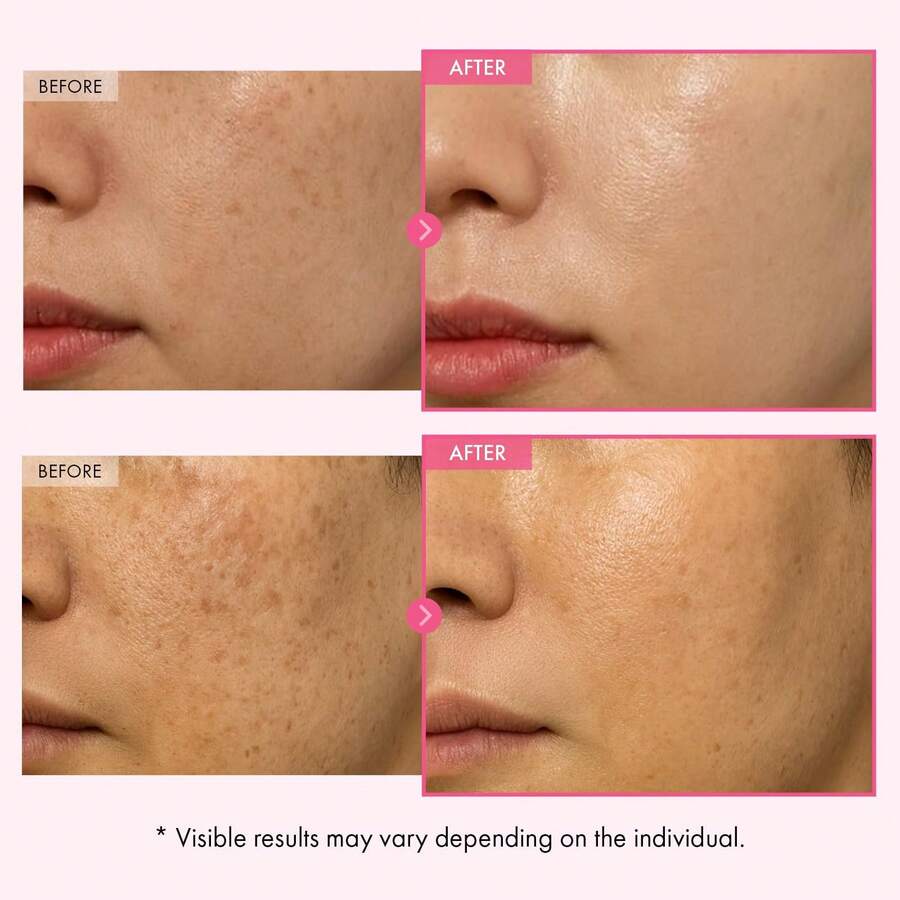70000ppm Arbutin & 5001ppm Glutathione Niacinamide Cream, Fade Pigmentation Dullness, Korean Skincare 1.69fl.Oz, Ideal 4th Of July Gift - 2PC - 查看 1